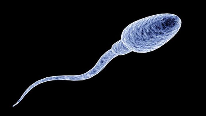  патологии размера спермии
